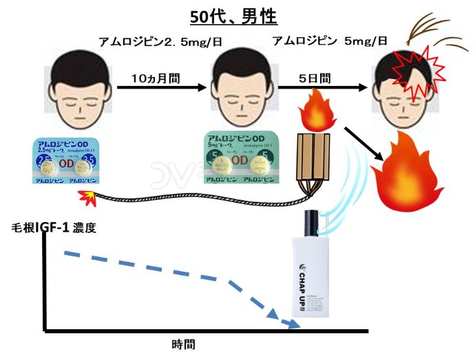 円形脱毛症　病院
